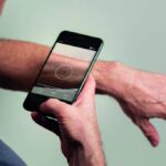 SkinVision lanceert AI-platform voor huidchecks in de zorg