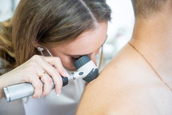Nederlands platform Derm2Check combineert AI met dermatologen
